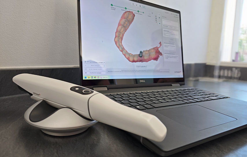 Digitale Darstellung von einem Gebiss auf einem Laptop. 